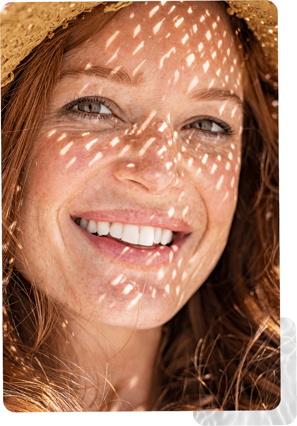 Brow Lift Stamford 10 Brow Lift